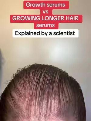 Scalp health is so underrated…
