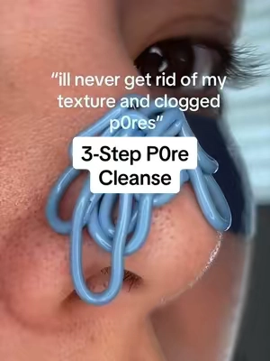 genuinely have the clearest skin of my entire life now 