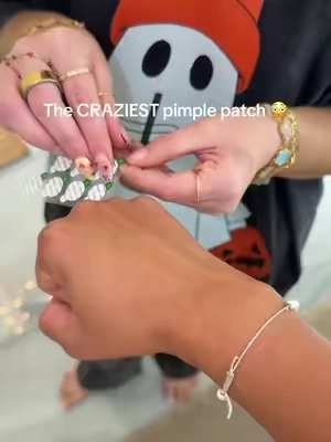 The craziest pimple patches I have ever seen 🤧🤧🤧 #pimplepatches #acnehacks #acnepatches #pimplepopping #cysticacne 